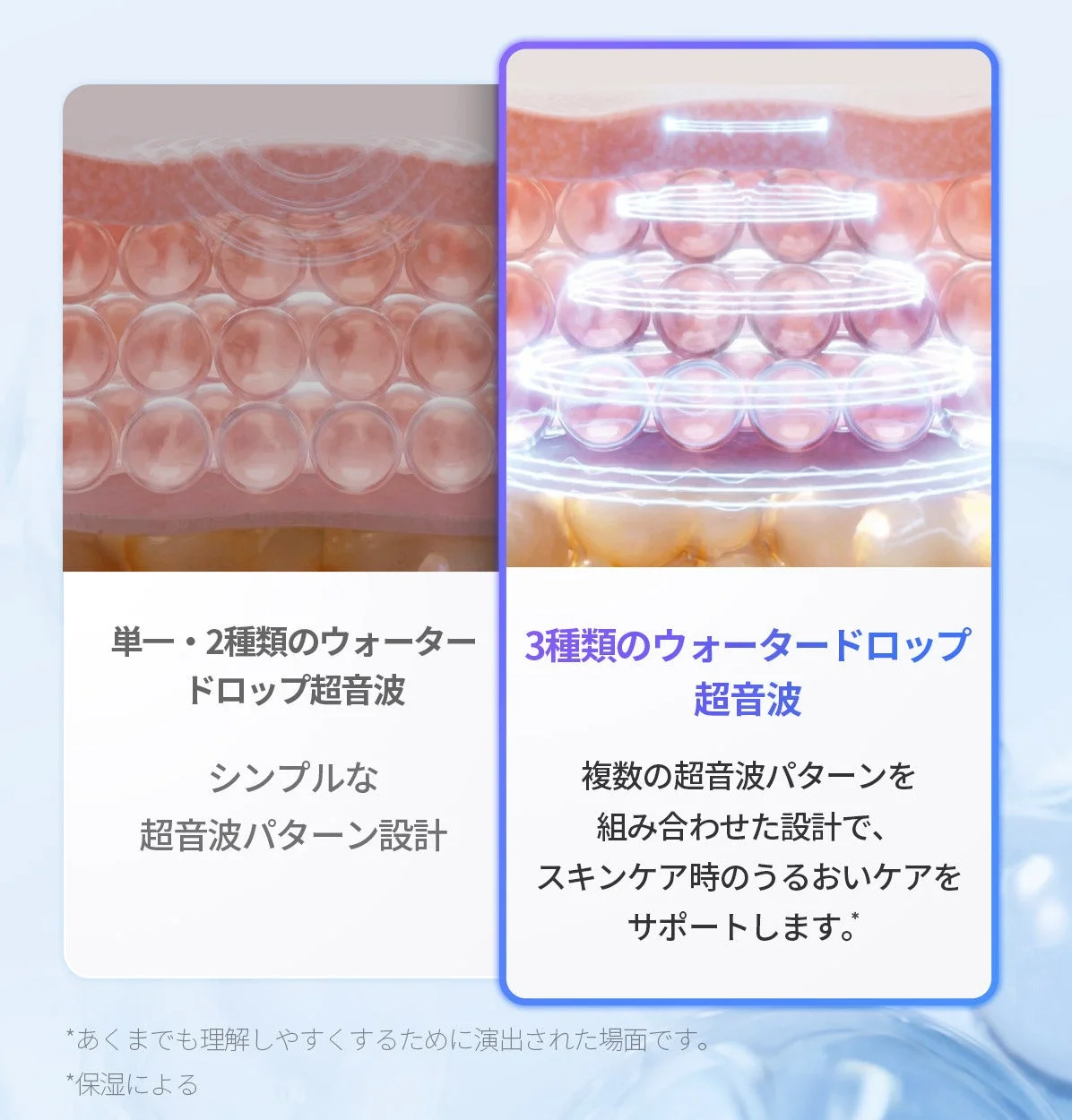 超音波パターンの比較