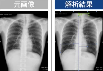 自動CTR推定機能の解析結果