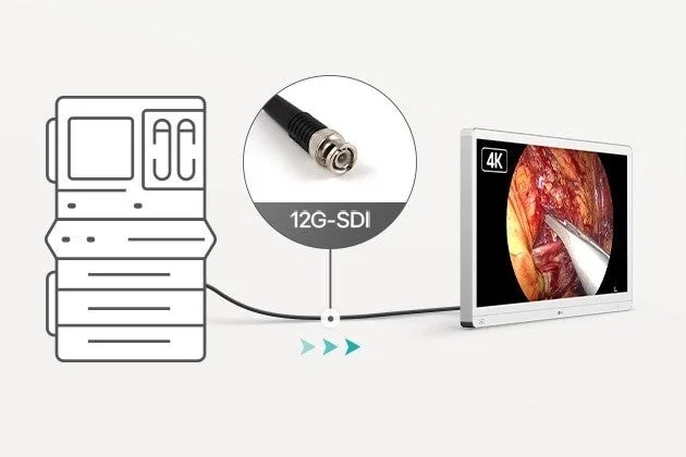 12G-SDI接続の内視鏡手術モニター