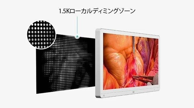 1.5Kローカルディミングゾーンの医療用モニター