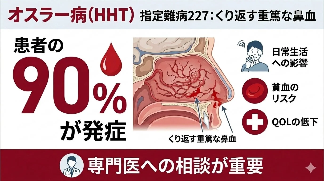 オスラー病（HHT）に関する情報。指定難病227に分類され、90%の患者が繰り返す重篤な鼻血を発症すると説明されています。