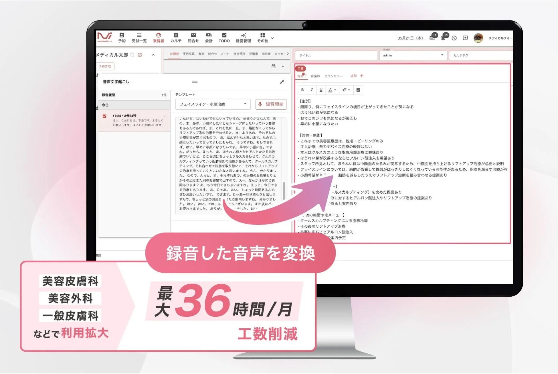 AI音声カルテの画面と効果