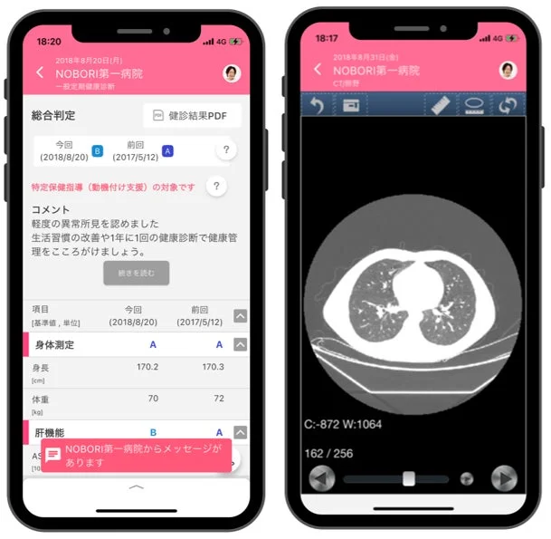 NOBORIアプリ画面