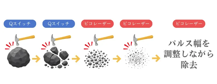 除去イメージ