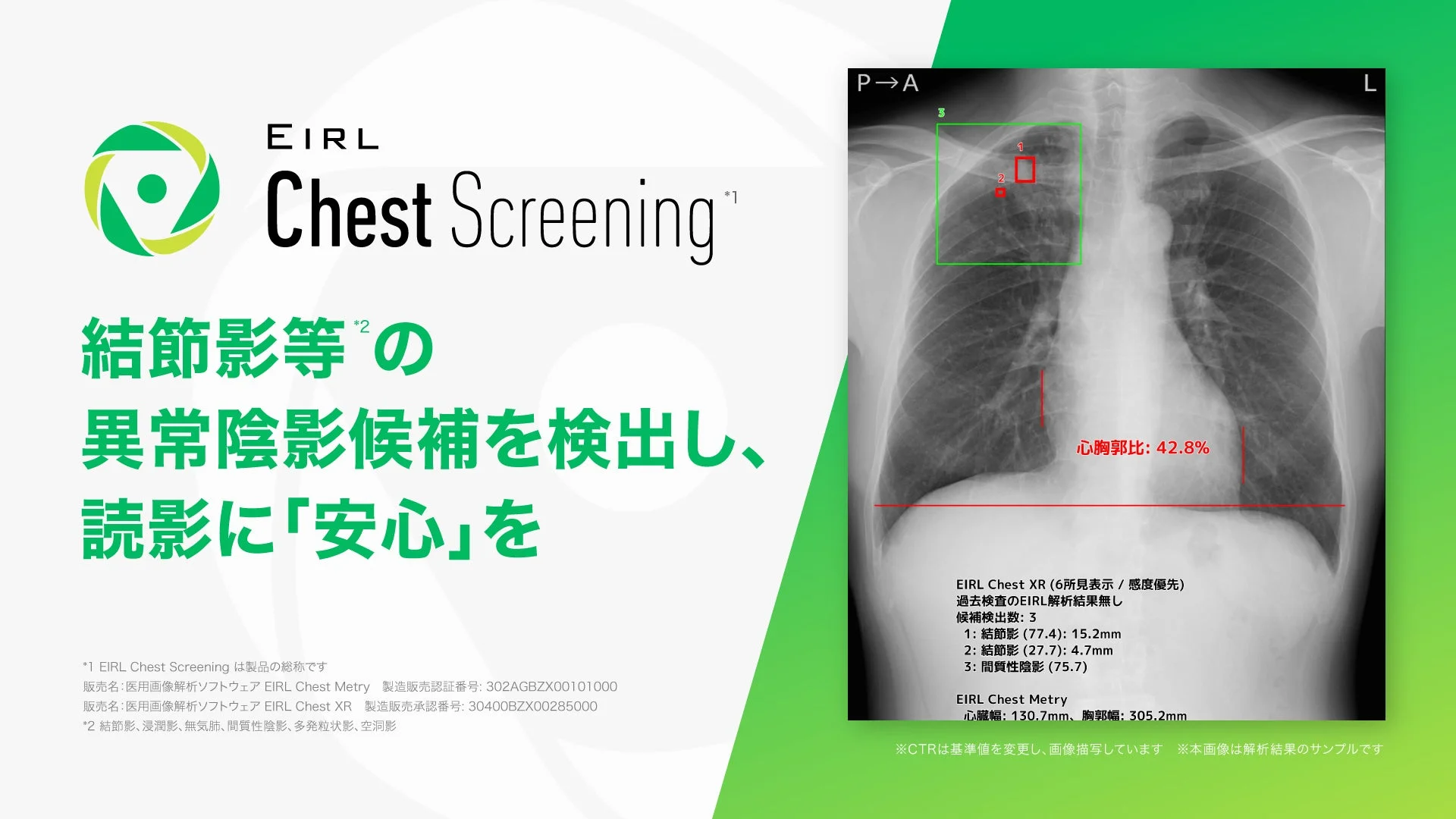 EIRL Chest Screeningの画面イメージ